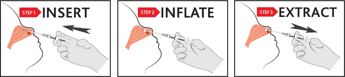 Simple 3-step process for extraction